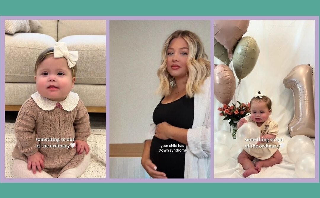 Gen Z mom’s powerful message is changing how the world sees Down syndrome